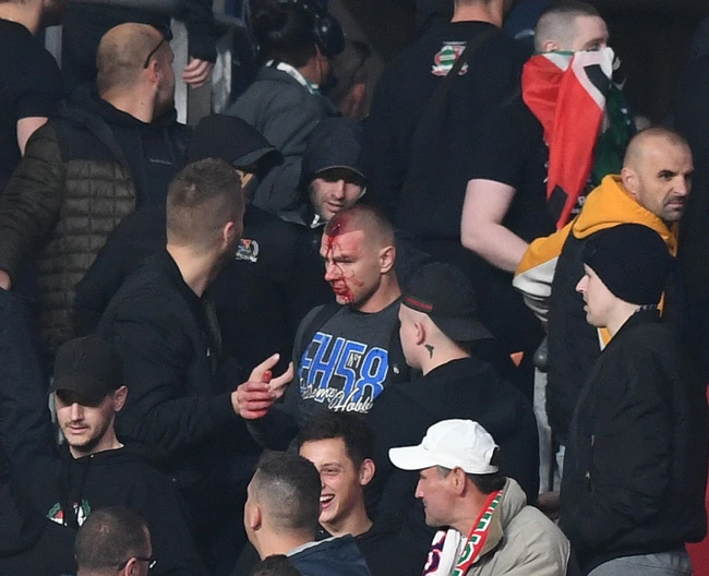 ¡Hay disturbios en Inglaterra!Los fans y los guardias de Seguridad se enfrentaron a un caos sangriento